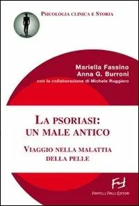 La psoriasi un male antico. Viaggio nella malattia della pelle Solo Oggi