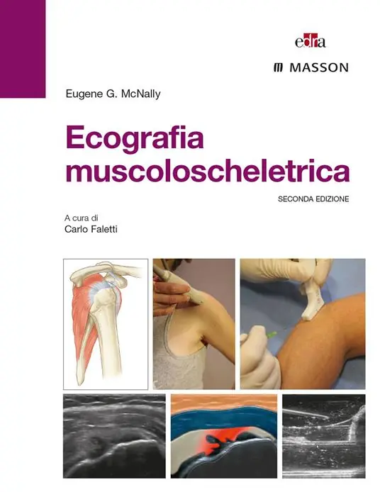 Scelto Dai Clienti Ecografia muscoloscheletrica. Ediz. illustrata