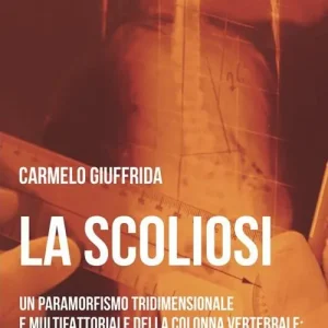 La scoliosi. Un paramorfismo tridimensionale e multifattoriale della colonna vertebrale dalle osservazioni e valutazioni alla ginnastica correttiva Bestseller