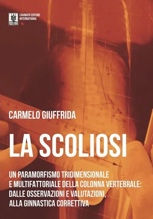 La scoliosi. Un paramorfismo tridimensionale e multifattoriale della colonna vertebrale dalle osservazioni e valutazioni alla ginnastica correttiva Bestseller