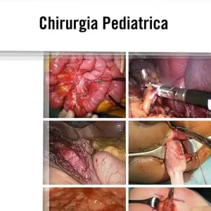 Chirurgia pediatrica Compra Online
