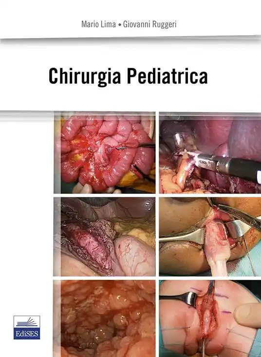 Chirurgia pediatrica Compra Online