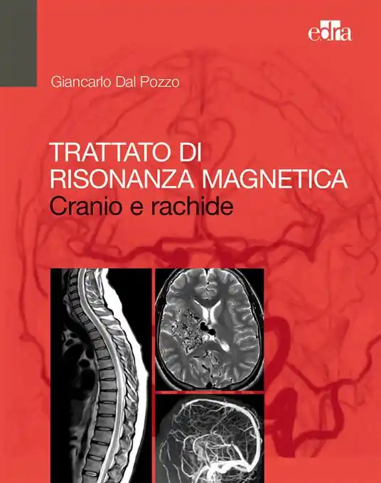 Trattato di risonanza magnetica. Cranio e rachide Compra Online