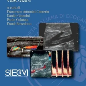 Ultimissimo Modello Manuale di ecografia vascolare