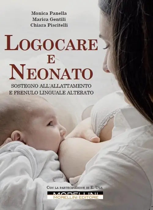 Logocare e neonato. Sostegno all‘allattamento e frenulo linguale alterato. Con espansione online Offerta Del Giorno